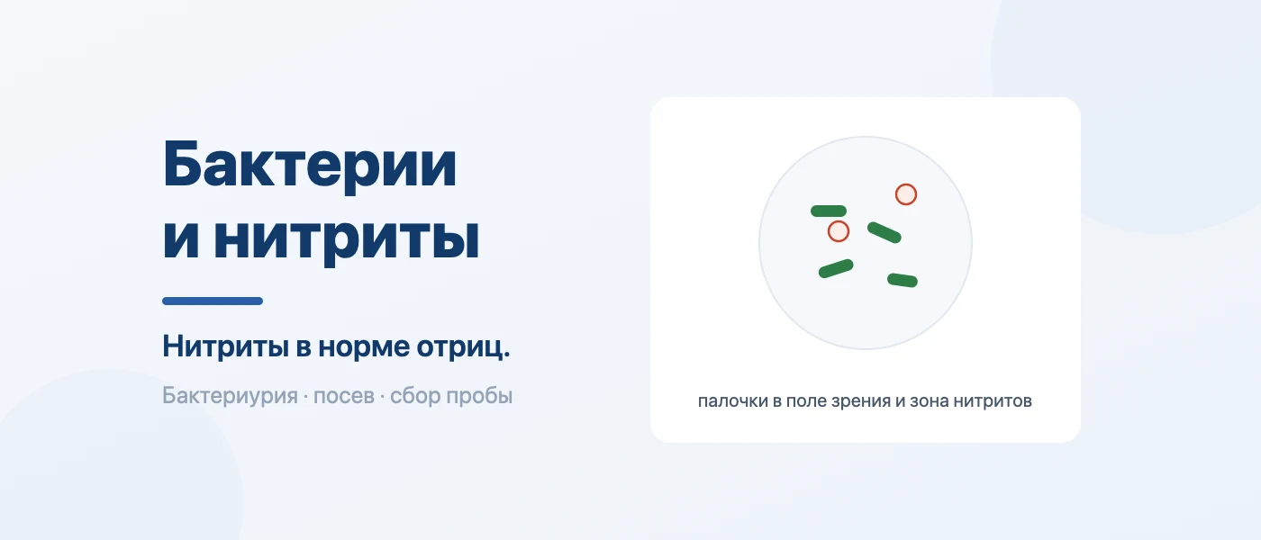 Иллюстрация к статье: Бактерии в моче и нитриты: что это значит и какая норма