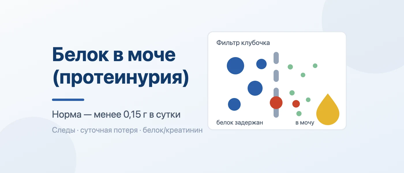 Иллюстрация к статье: Белок в моче: норма, причины протеинурии и что делать