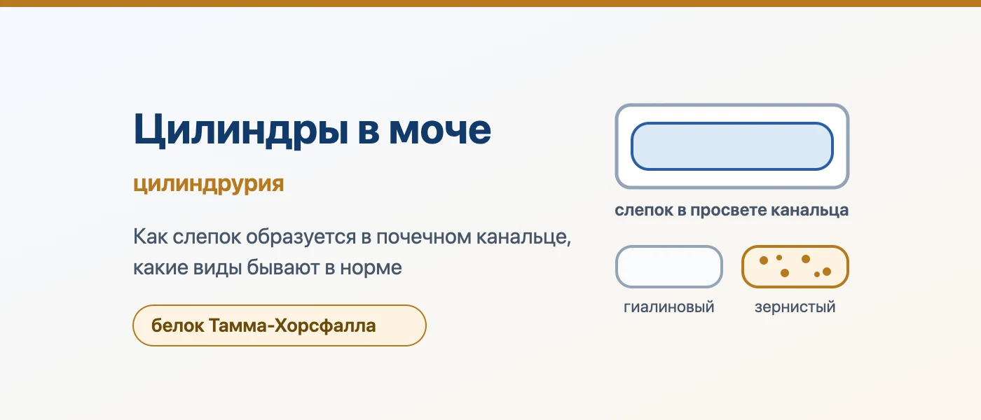 Иллюстрация к статье: Цилиндры в моче: норма, виды цилиндров и что значит цилиндрурия
