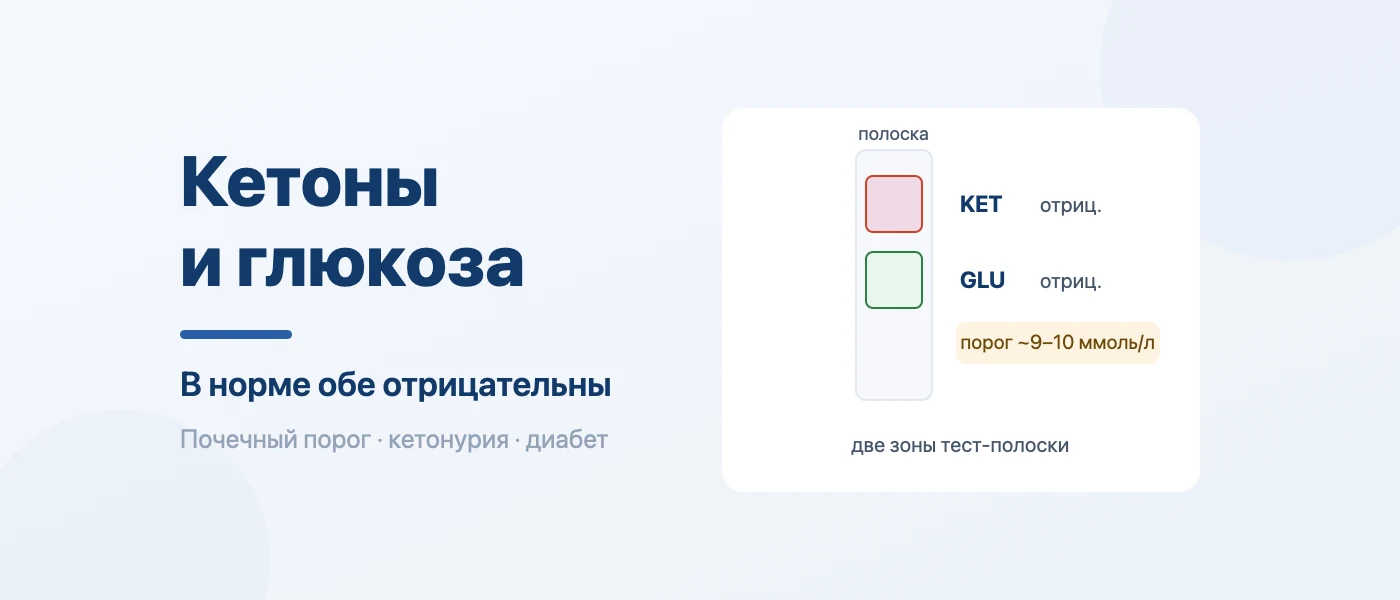 Обложка статьи: Кетоны и глюкоза в моче: норма и причины появления