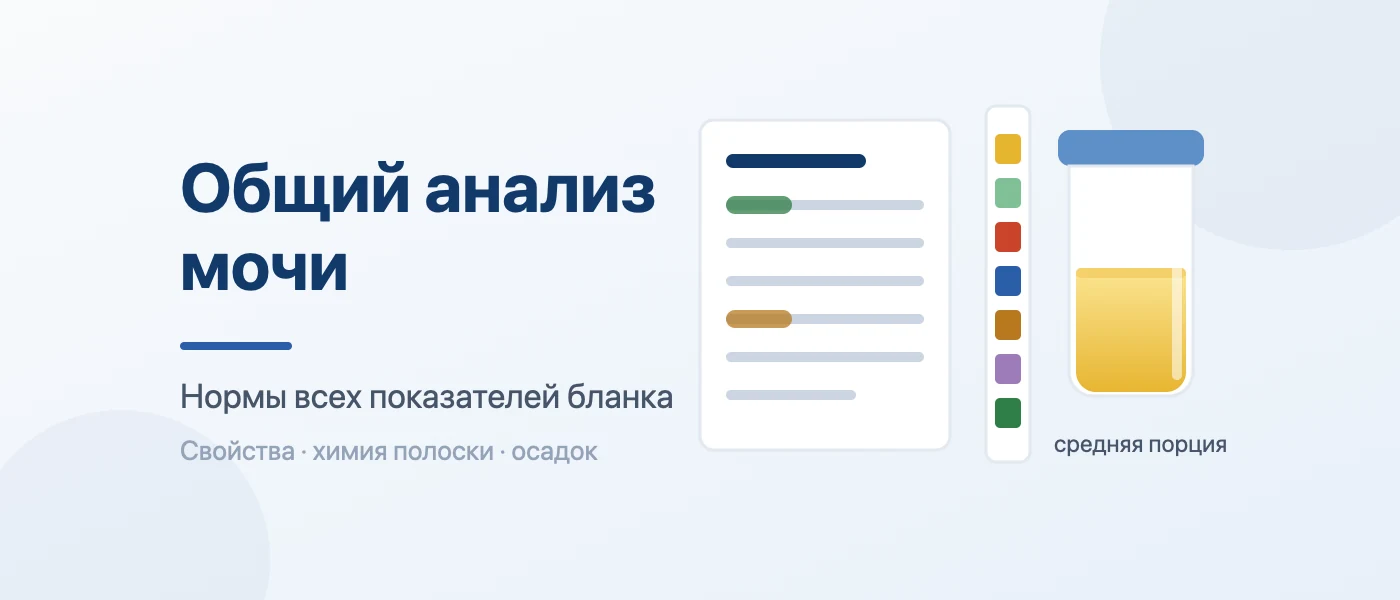 Обложка статьи: Общий анализ мочи: расшифровка и норма показателей у взрослых