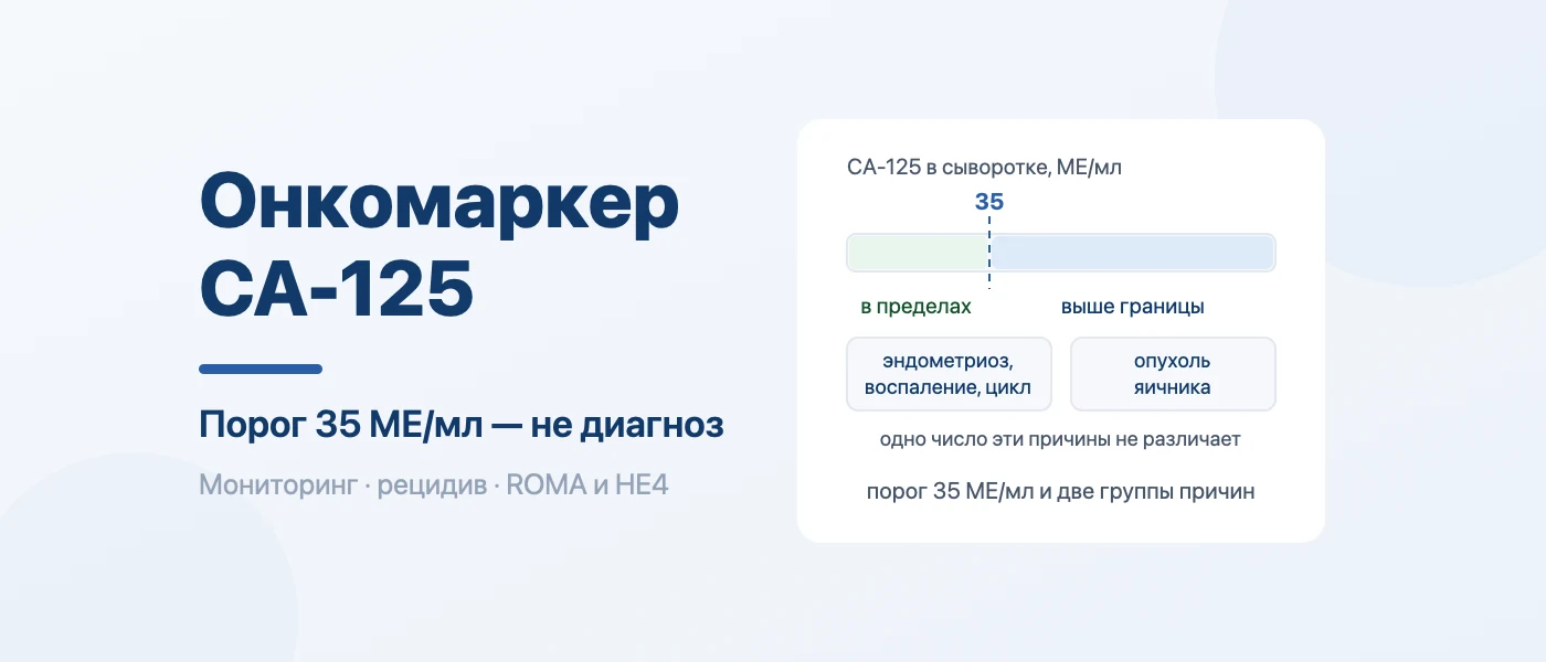 Обложка статьи: Онкомаркер СА 125: норма у женщин и что значит повышенный